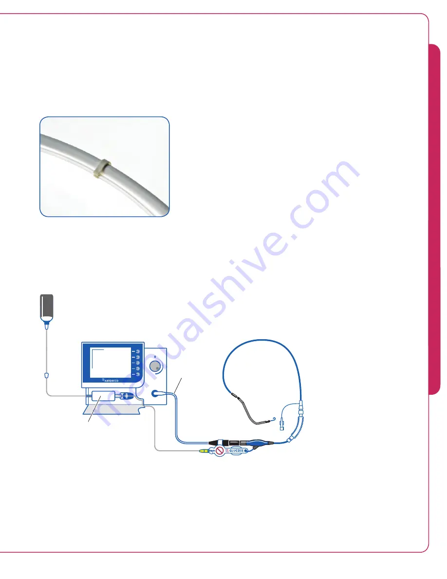 Abiomed Impella RP Instructions For Use & Clinical Reference Manual Download Page 46