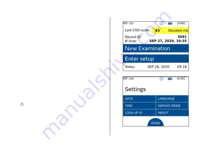 acarix CADScor System User Manual Download Page 33