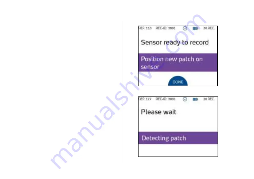 acarix CADScor System User Manual Download Page 58