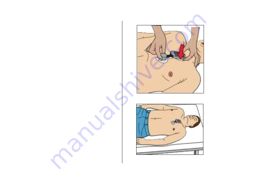 acarix CADScor System User Manual Download Page 62