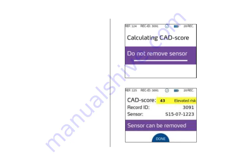 acarix CADScor System Скачать руководство пользователя страница 68