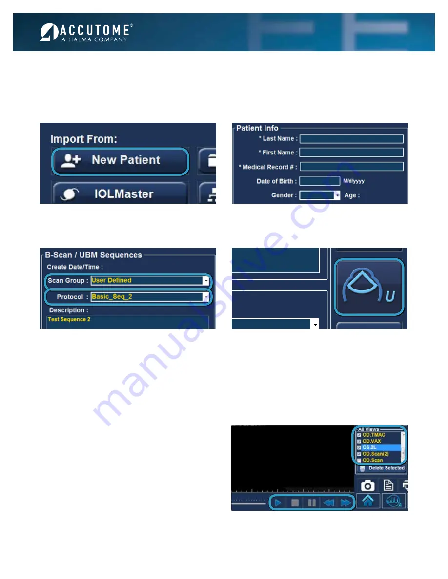 Accutome 4Sight Quick Reference Manual Download Page 6