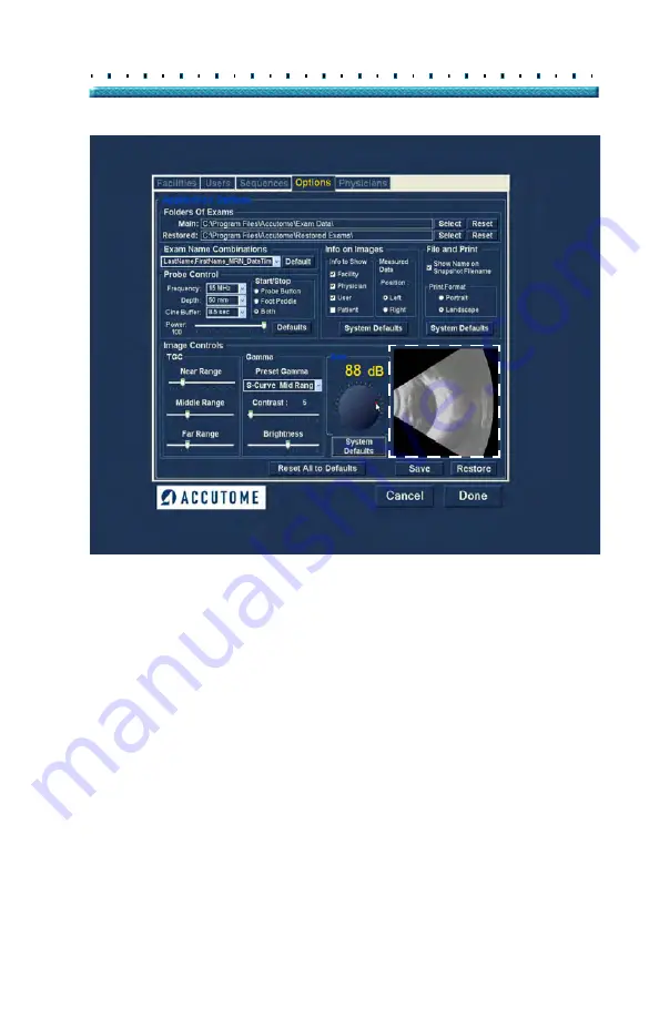 Accutome B-Scan Plus User Manual Download Page 101