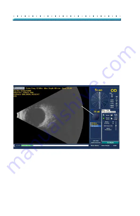 Accutome B-Scan Plus User Manual Download Page 144