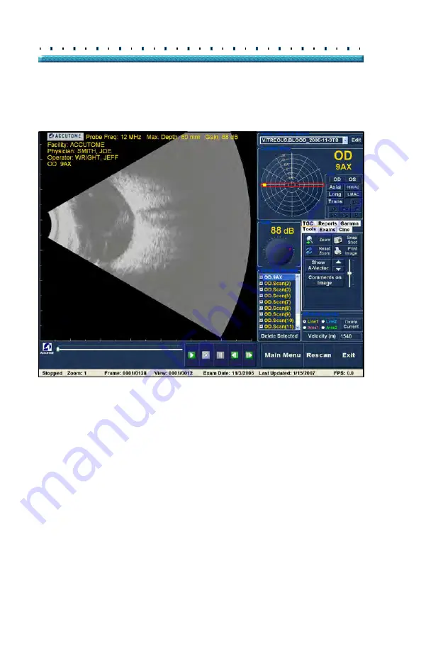 Accutome B-Scan Plus User Manual Download Page 162