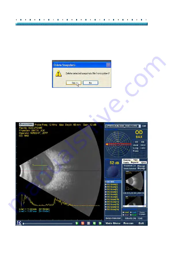 Accutome B-Scan Plus Скачать руководство пользователя страница 202