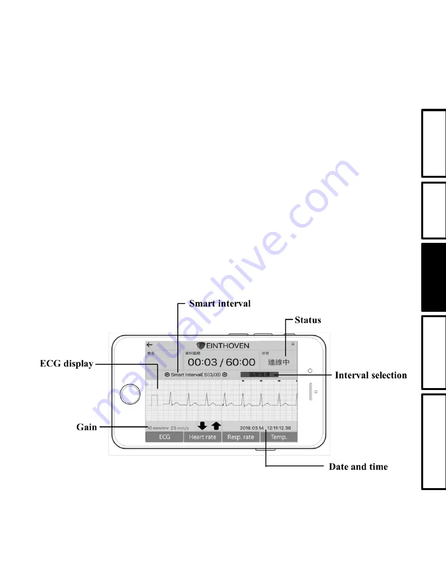 ACE Solution Einthoven CR1000 User Manual Download Page 24