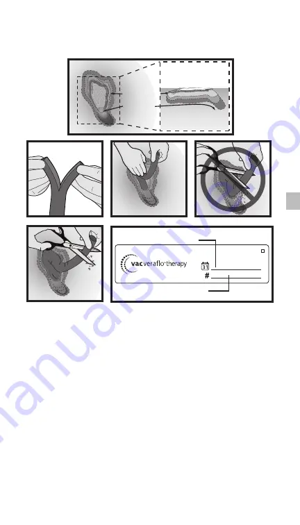 Acelity V.A.C. Ulta Therapy System Safety Information And Instructions Download Page 119