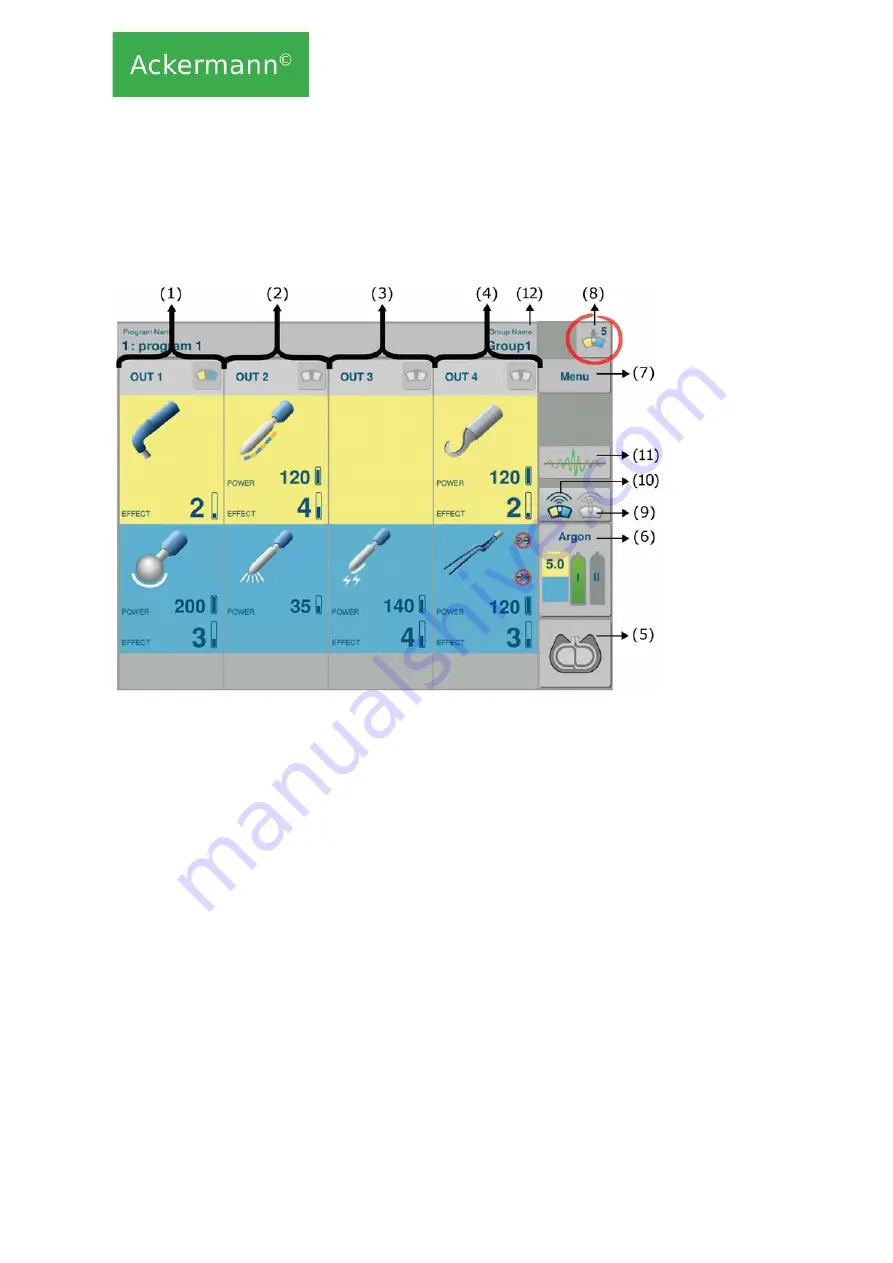 ACKERMANN 16-2000-700 Instructions For Use Manual Download Page 13