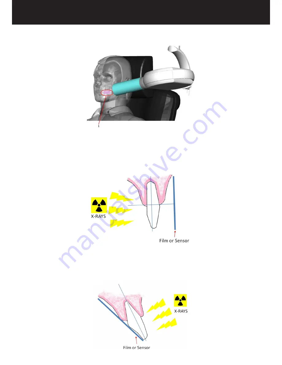 Acteon X-MIND unity Operator'S Manual Download Page 41