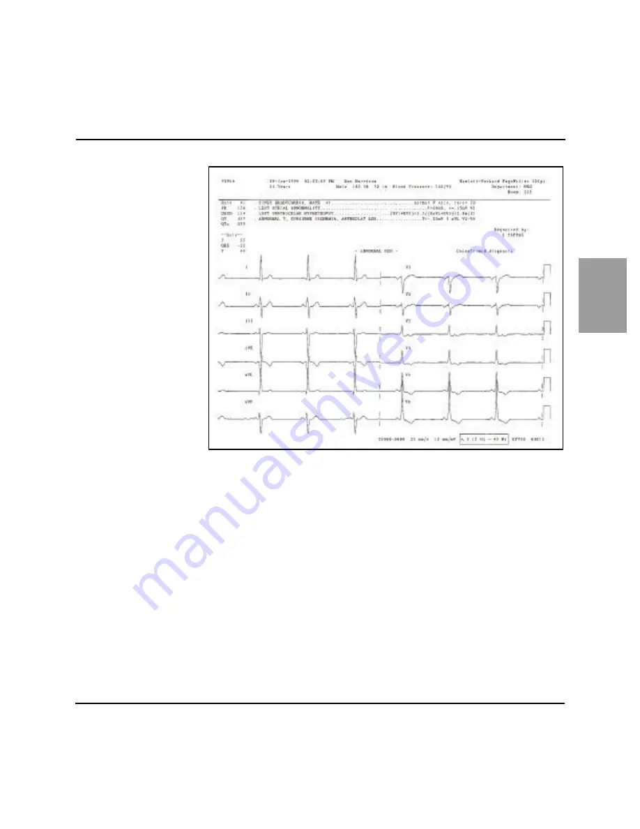 Agilent Technologies M1770A User Manual Download Page 50