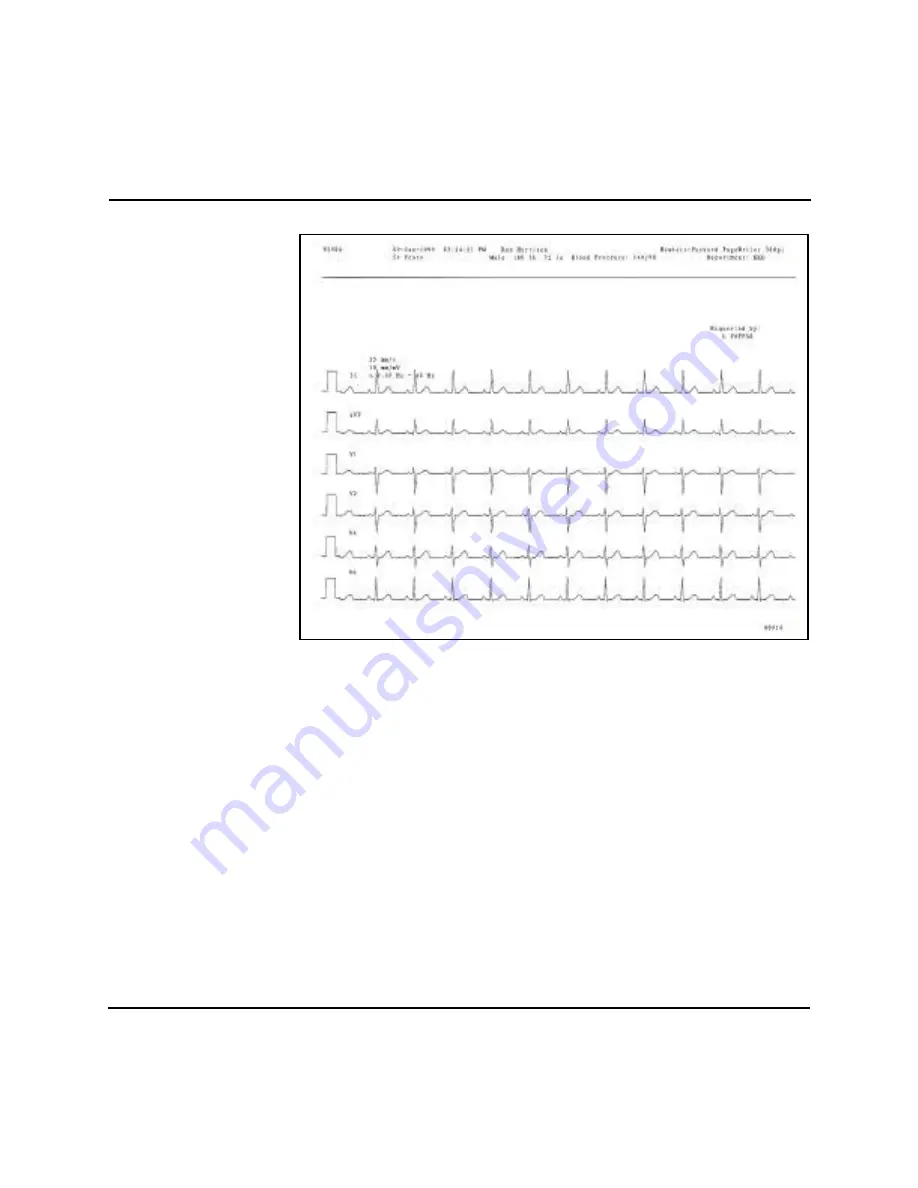 Agilent Technologies M1770A User Manual Download Page 53