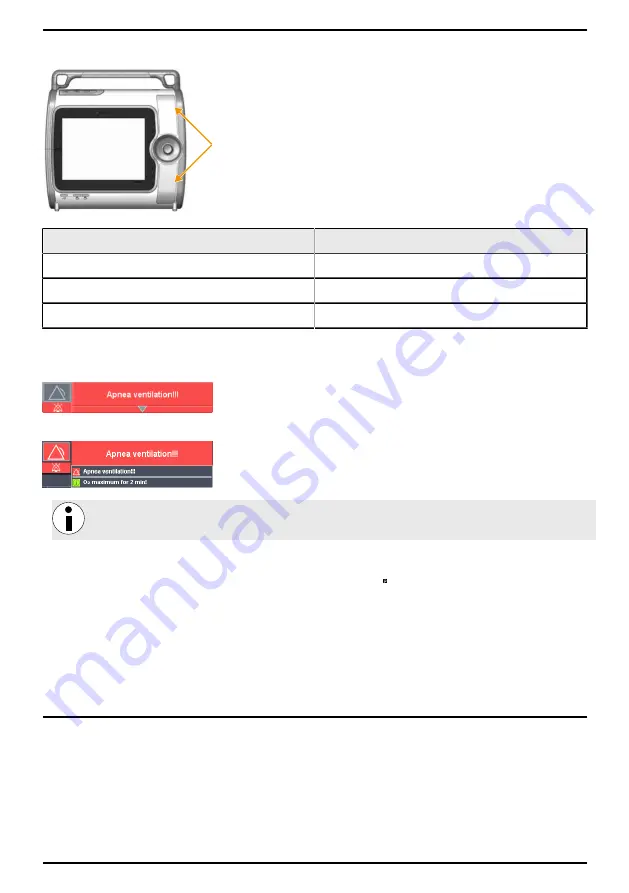 Air Liquide MONNAL T60 ADVANCED User Manual Download Page 80