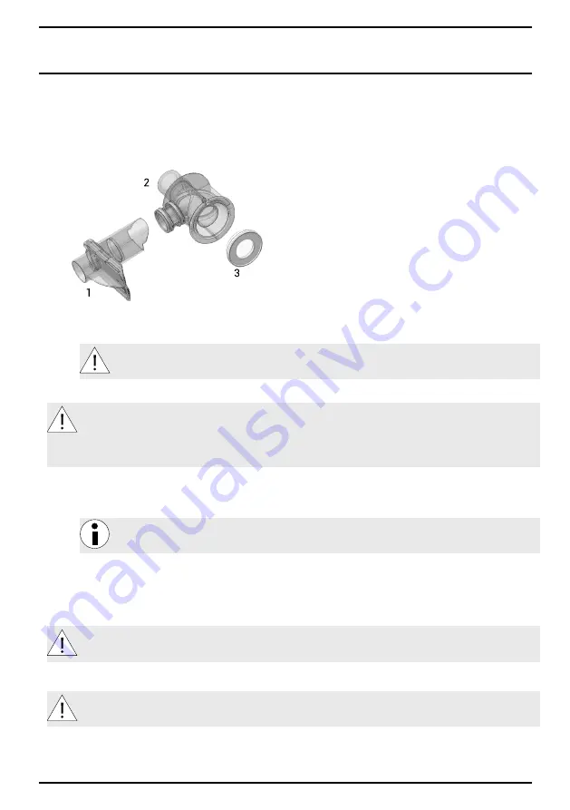 Air Liquide MONNAL T60 ADVANCED User Manual Download Page 141