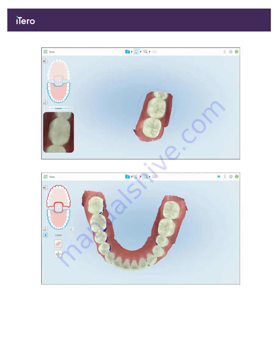 Align Technology iTero Element 5D User Manual Download Page 132