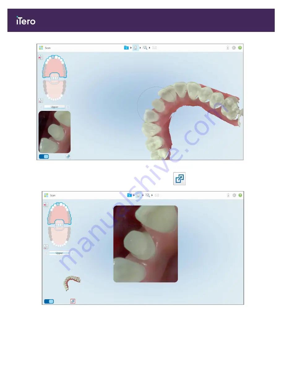 Align Technology iTero Element 5D User Manual Download Page 140