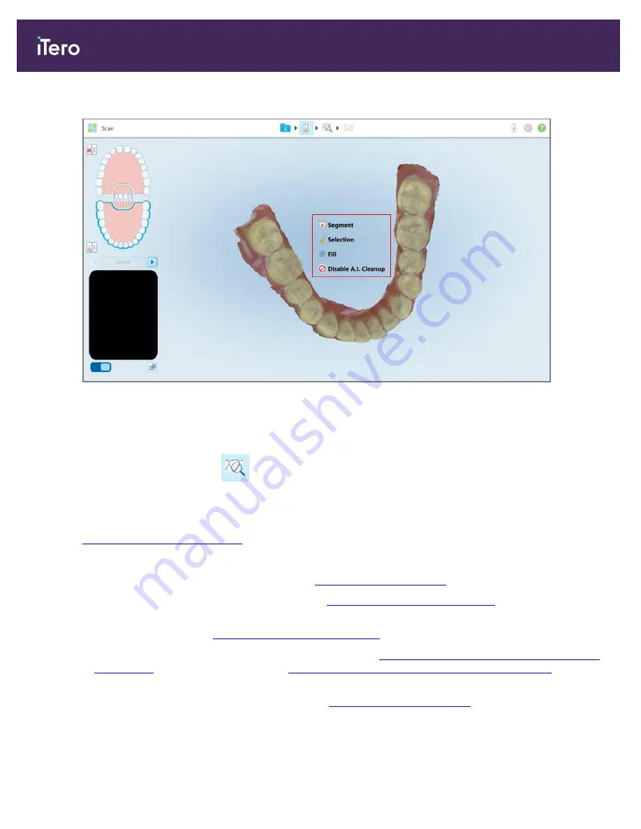 Align Technology iTero Element 5D Скачать руководство пользователя страница 142