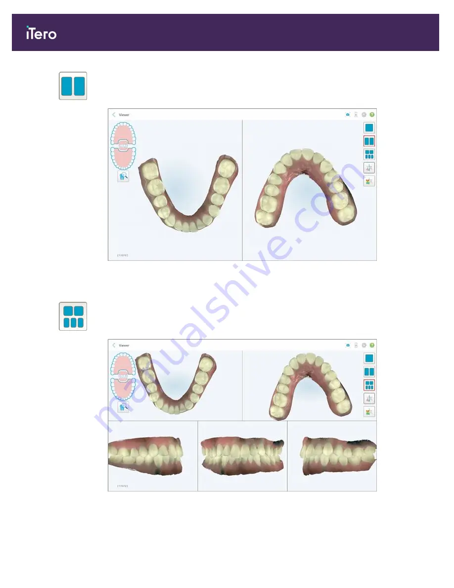 Align Technology iTero Element 5D Скачать руководство пользователя страница 148