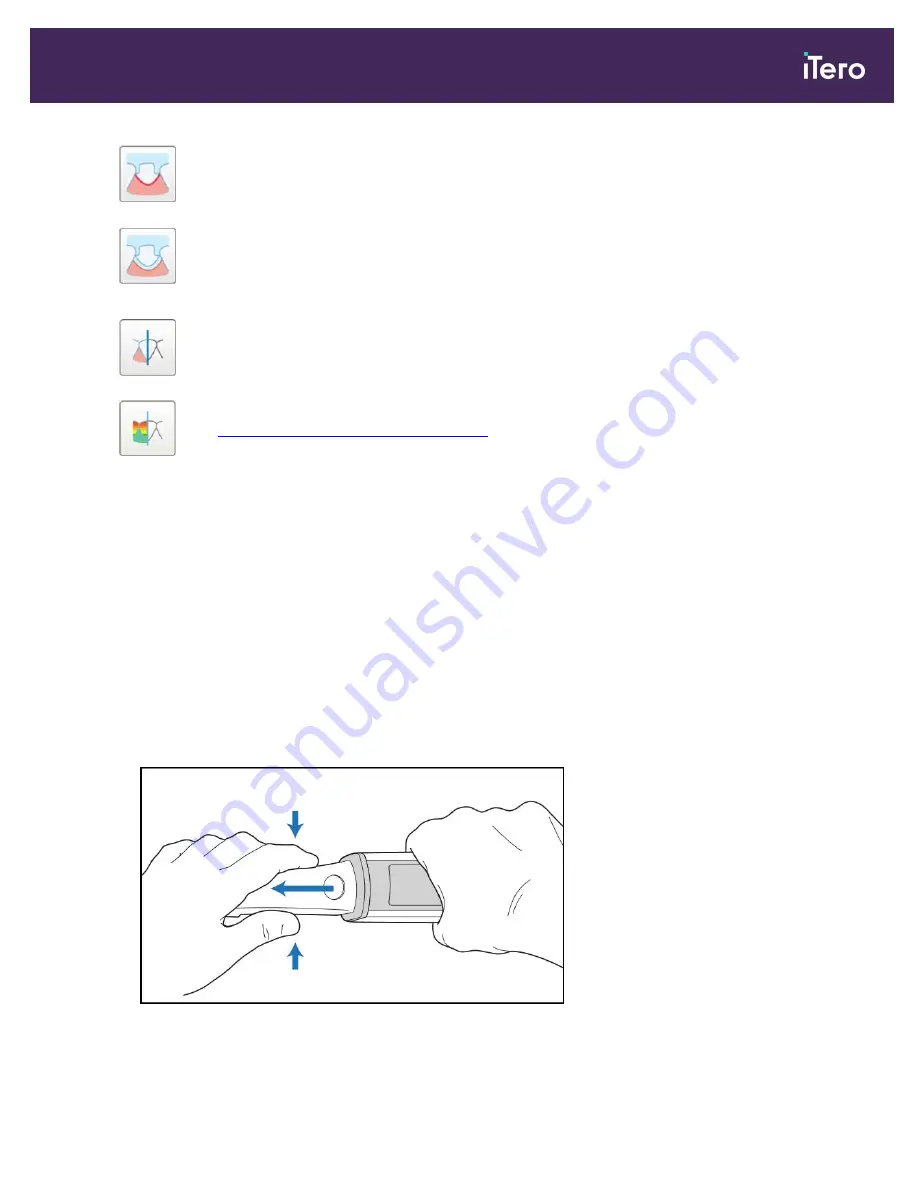 Align Technology iTero Element 5D User Manual Download Page 149