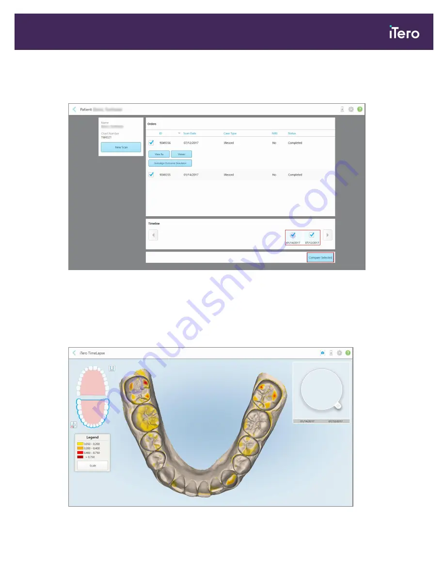 Align Technology iTero Element 5D User Manual Download Page 167