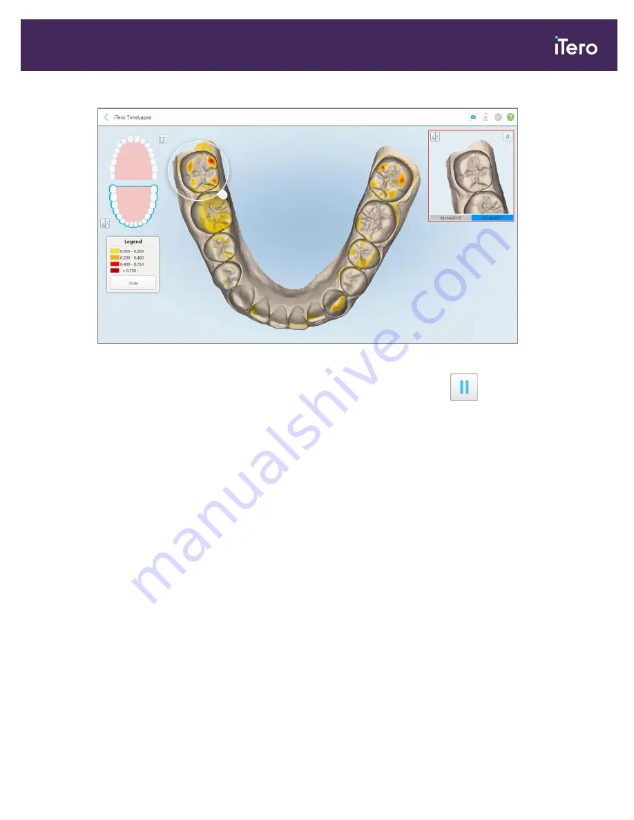 Align Technology iTero Element 5D Скачать руководство пользователя страница 169