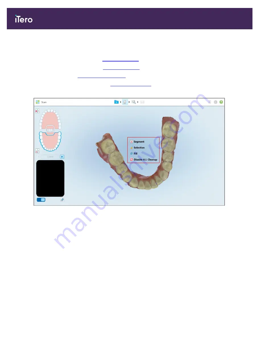 Align Technology iTero Element 5D User Manual Download Page 172