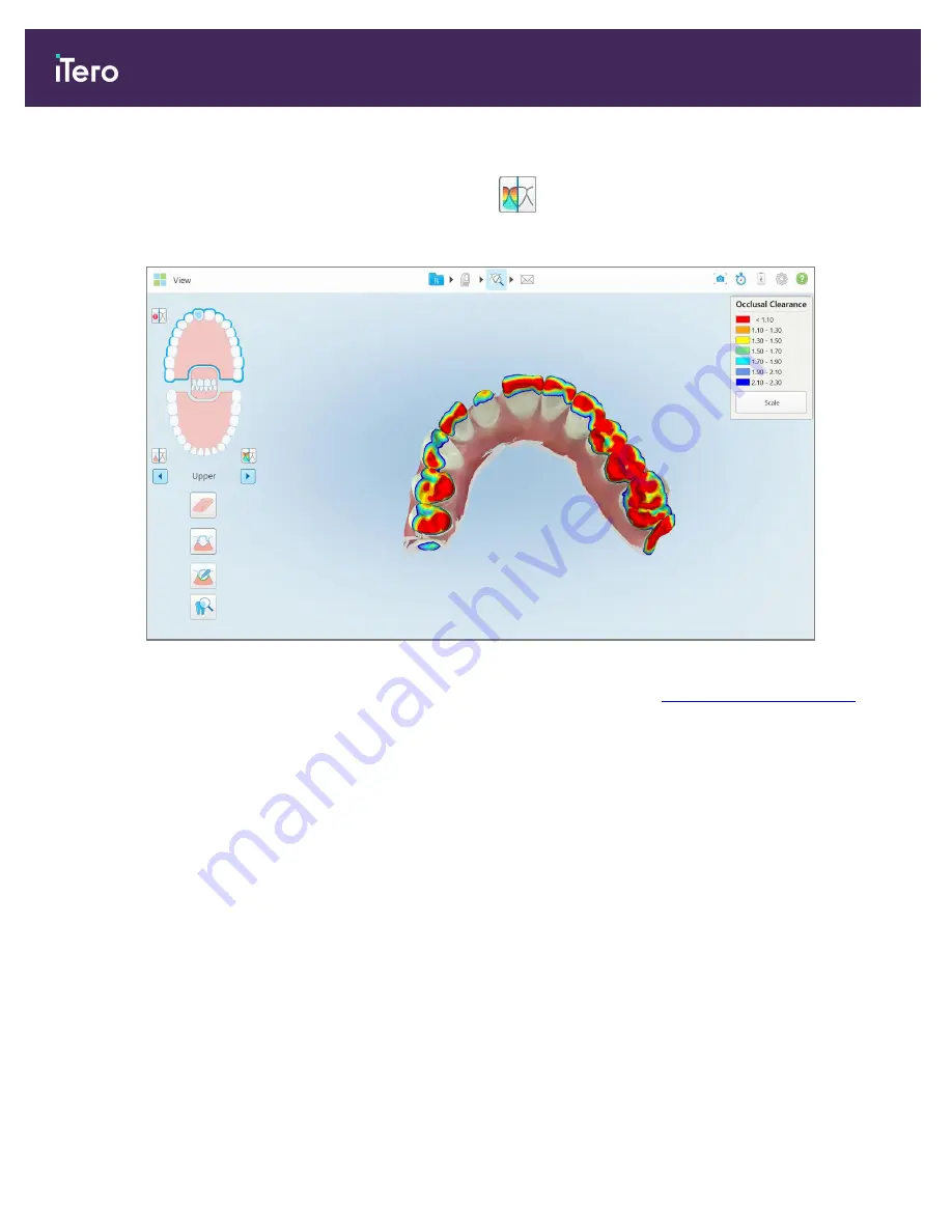 Align Technology iTero Element 5D User Manual Download Page 182