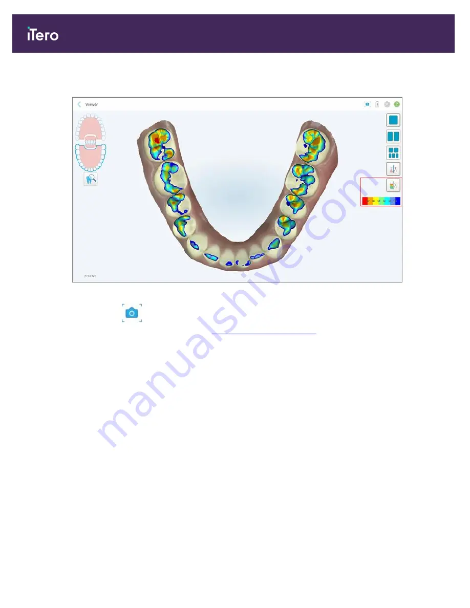 Align Technology iTero Element 5D Скачать руководство пользователя страница 184