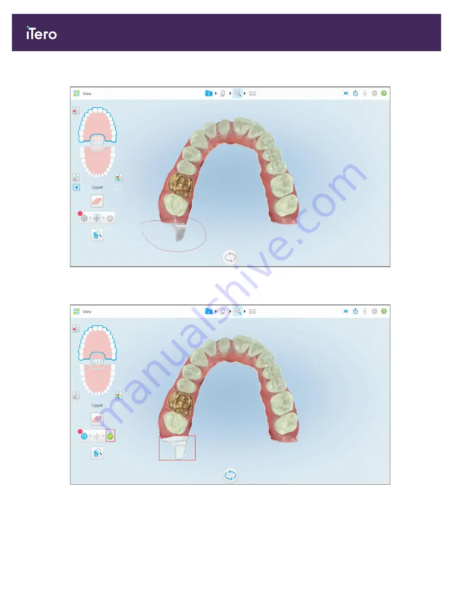 Align Technology iTero Element 5D User Manual Download Page 186