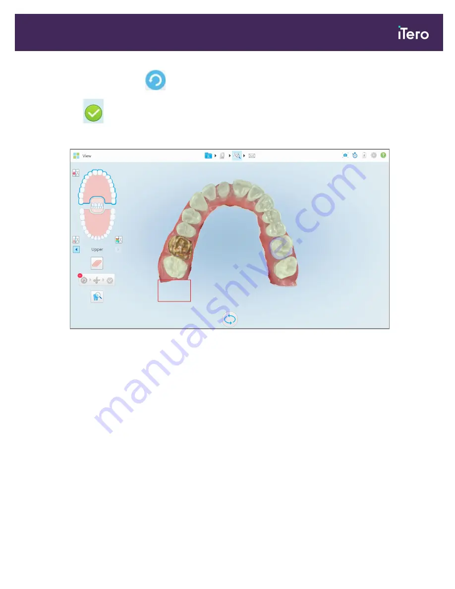 Align Technology iTero Element 5D User Manual Download Page 187