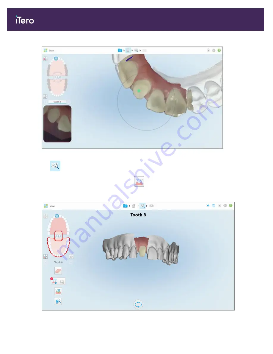 Align Technology iTero Element 5D Скачать руководство пользователя страница 188