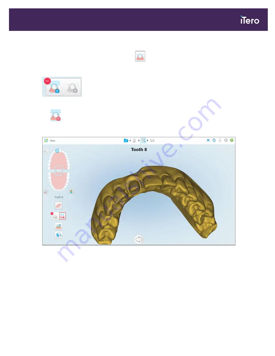 Align Technology iTero Element 5D Скачать руководство пользователя страница 189