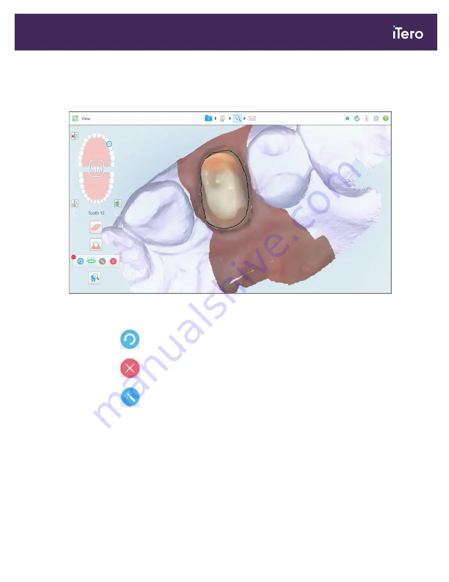 Align Technology iTero Element 5D User Manual Download Page 193