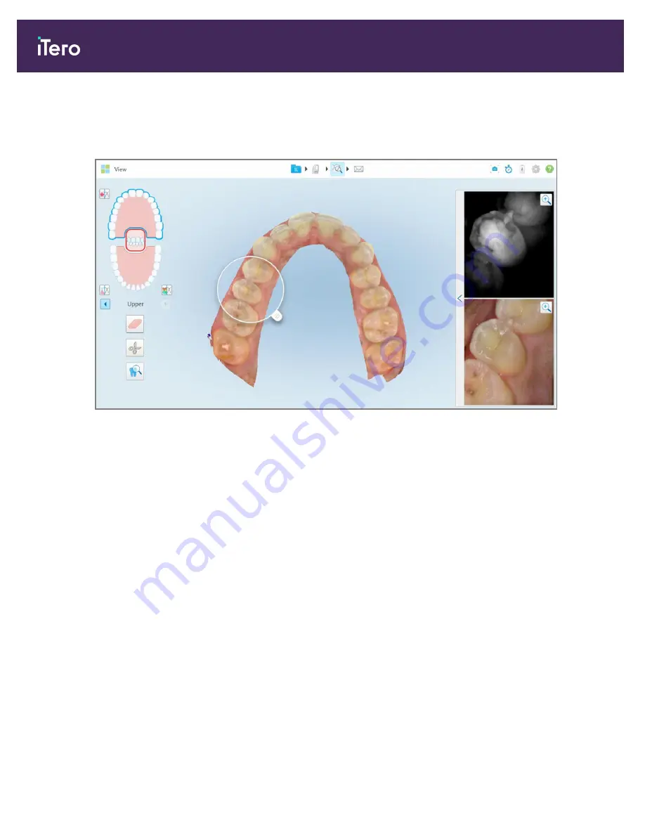 Align Technology iTero Element 5D User Manual Download Page 196