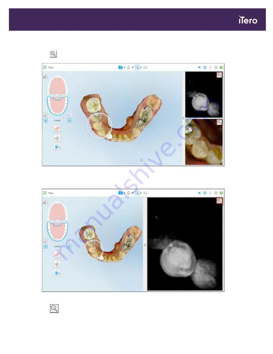 Align Technology iTero Element 5D Скачать руководство пользователя страница 197