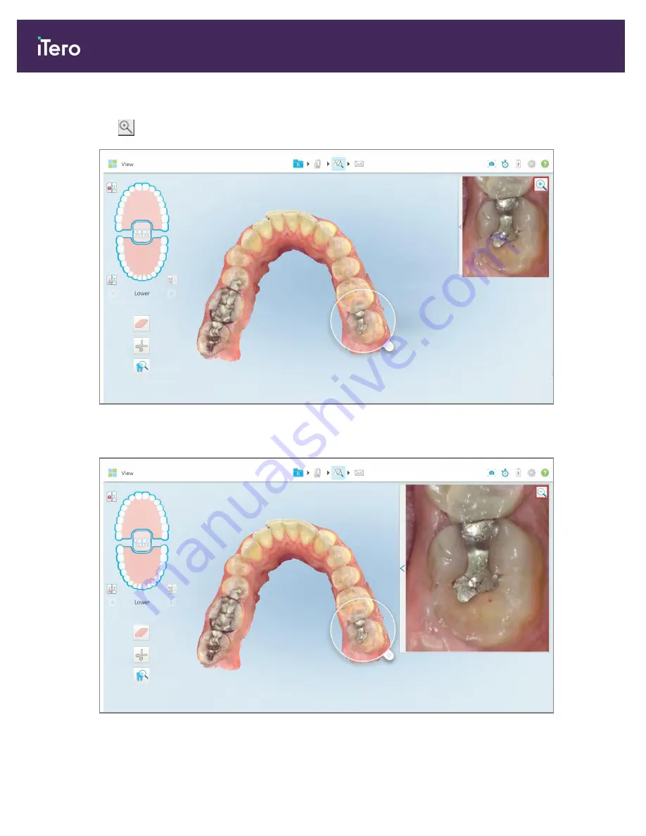 Align Technology iTero Element 5D Скачать руководство пользователя страница 202