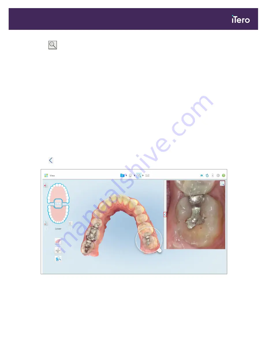 Align Technology iTero Element 5D Скачать руководство пользователя страница 203