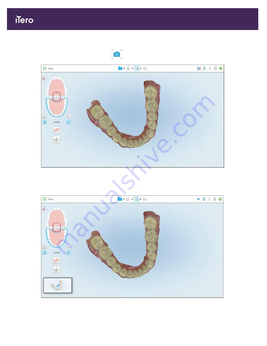 Align Technology iTero Element 5D User Manual Download Page 206