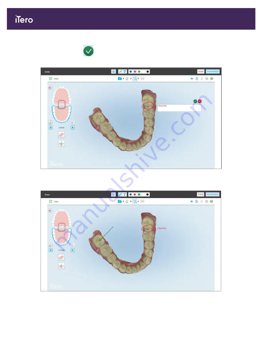 Align Technology iTero Element 5D User Manual Download Page 208