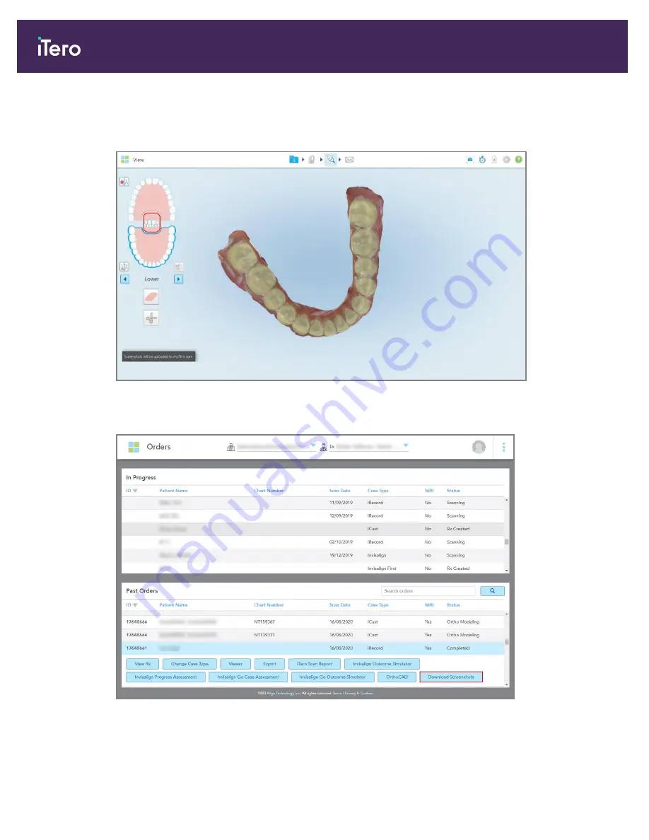 Align Technology iTero Element 5D User Manual Download Page 210