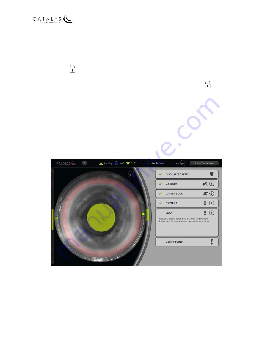 AMO Catalys OptiMedica Operator'S Manual Download Page 127