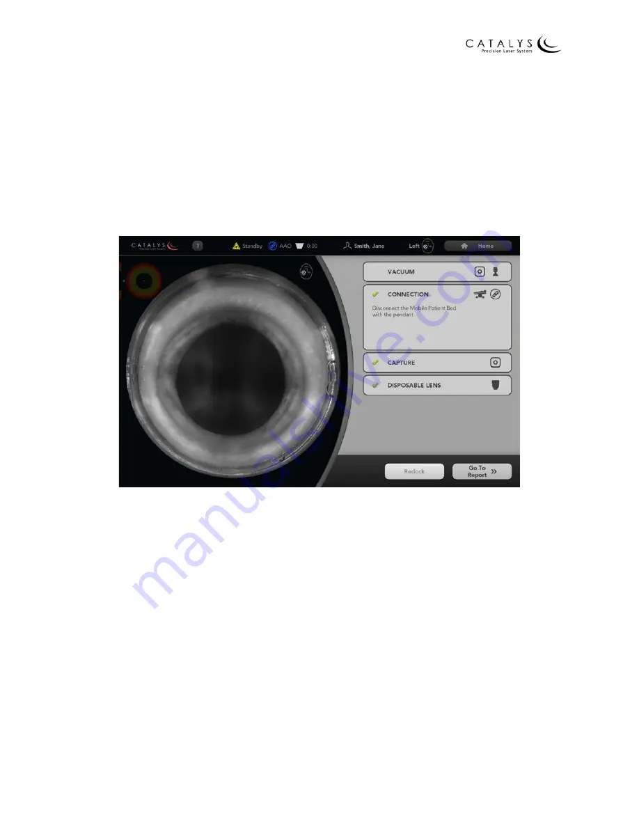 AMO Catalys OptiMedica Operator'S Manual Download Page 156