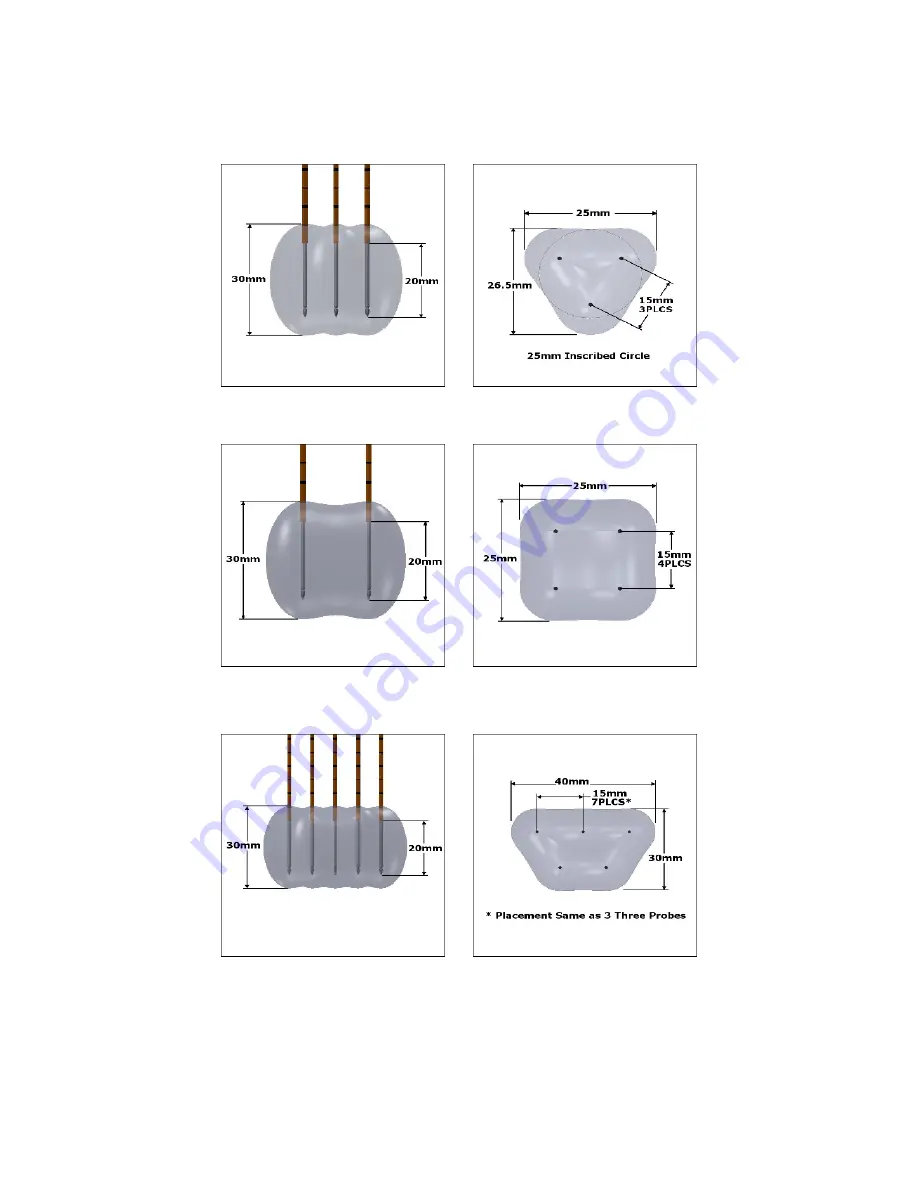 AngioDynamics NanoKnife User Manual Download Page 42