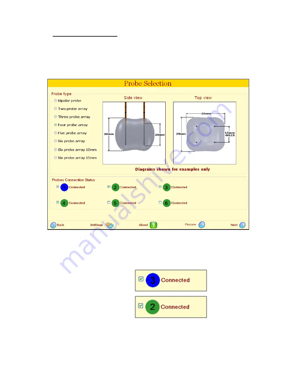 AngioDynamics NanoKnife User Manual Download Page 44