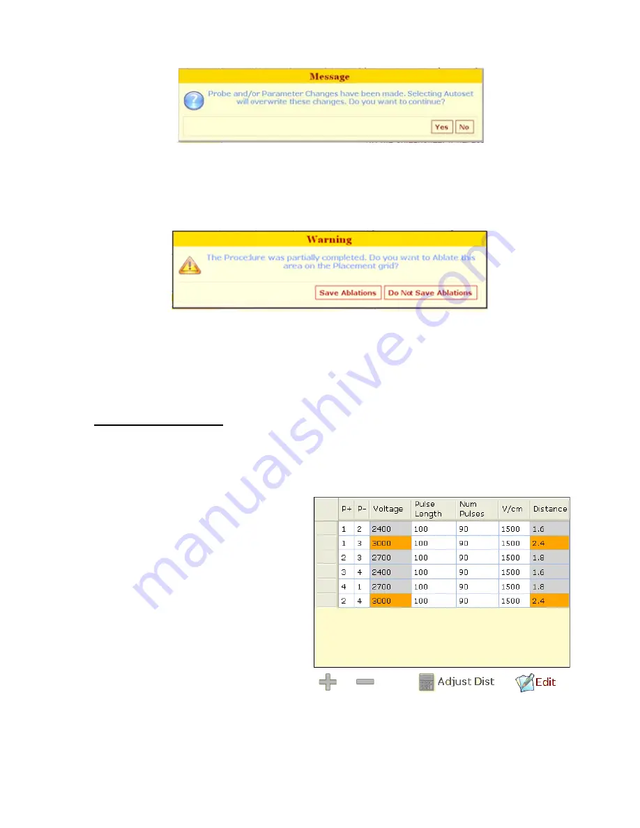 AngioDynamics NanoKnife User Manual Download Page 52