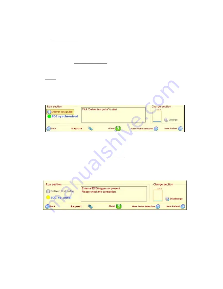 AngioDynamics NanoKnife User Manual Download Page 72