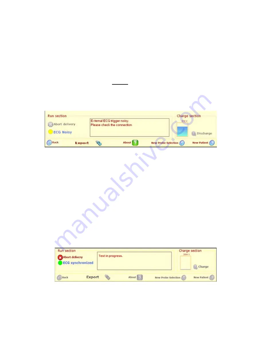 AngioDynamics NanoKnife User Manual Download Page 73