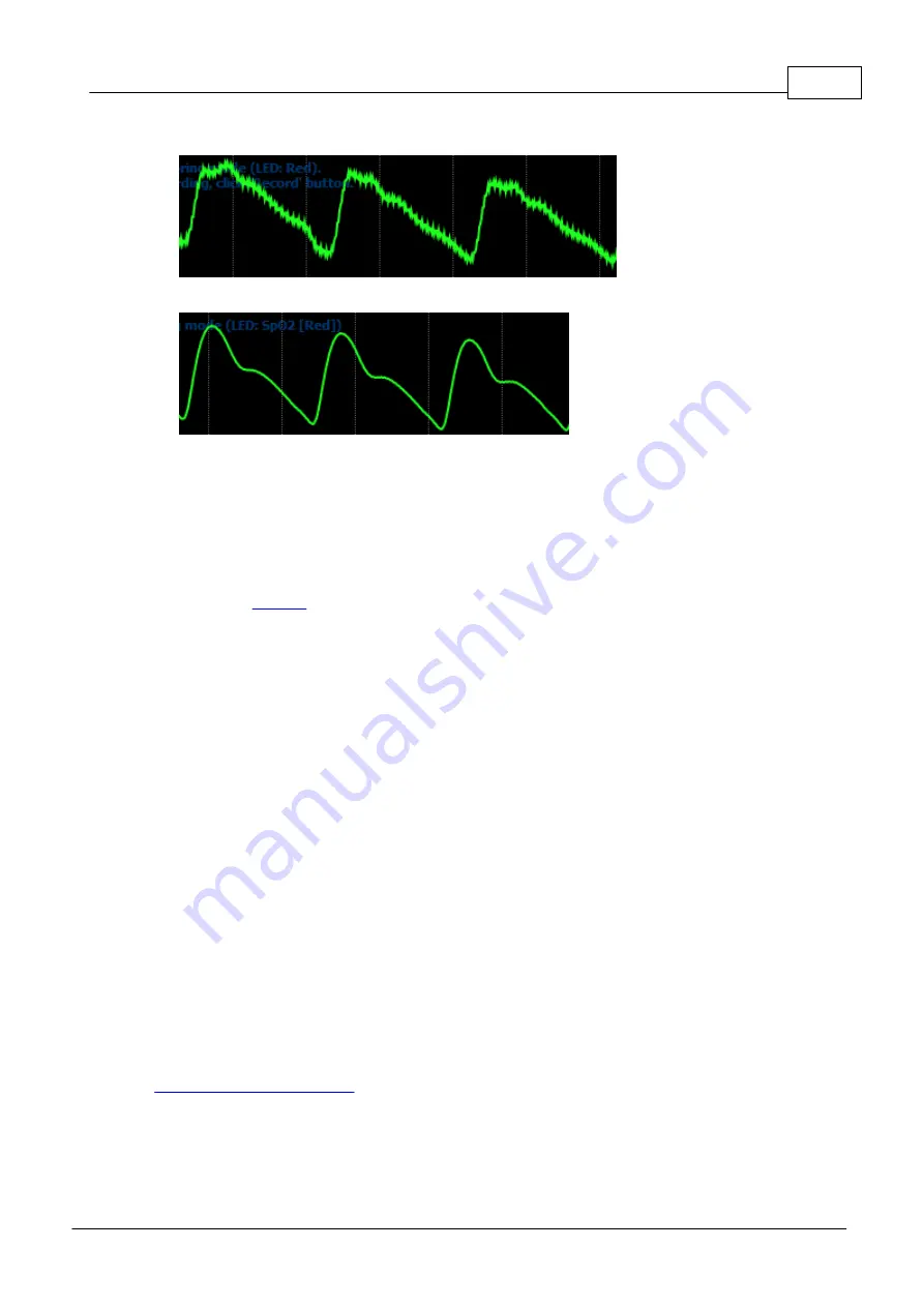 Angioscan Electronics AngioScan-01 User Manual Download Page 19