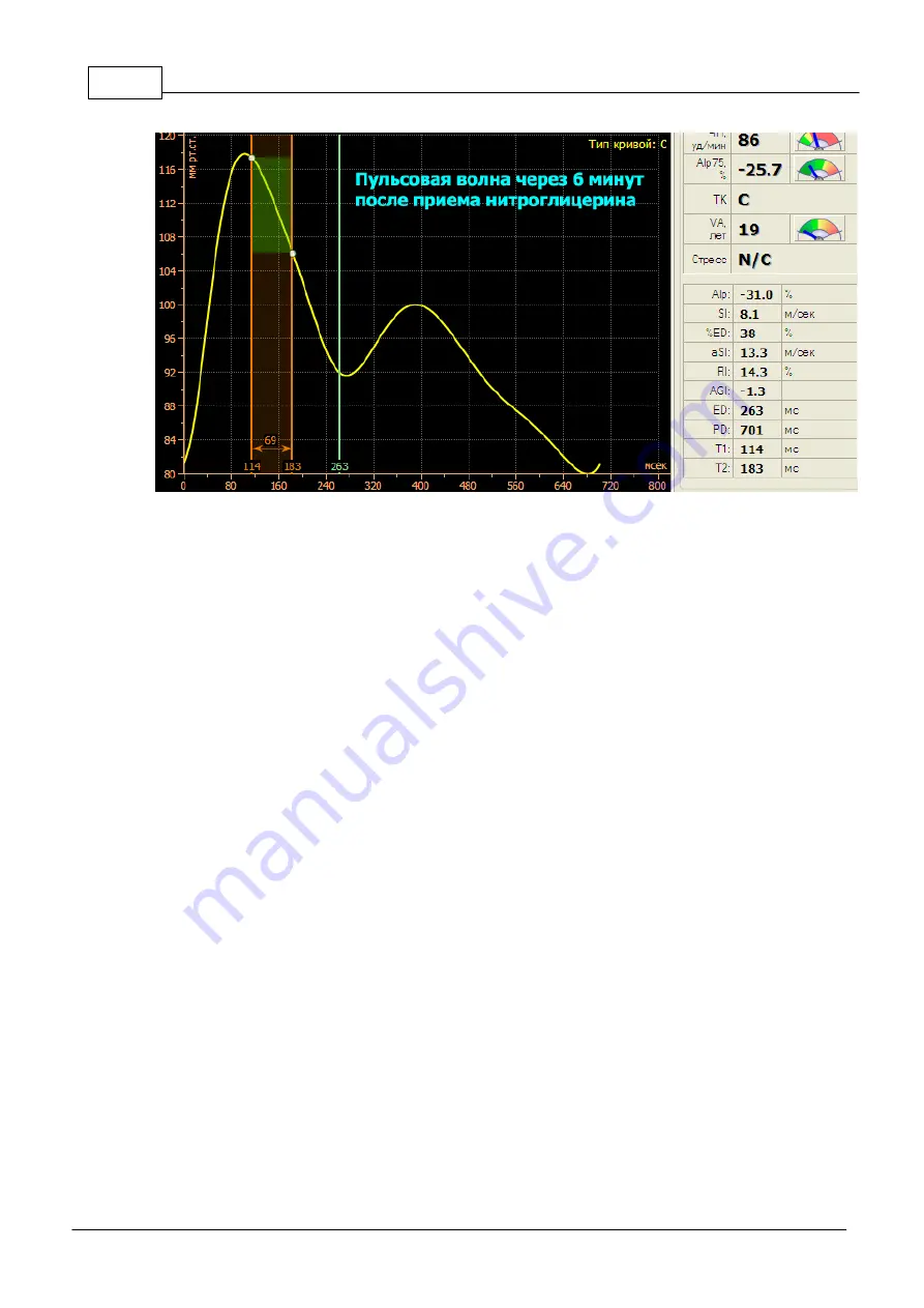 Angioscan Electronics AngioScan-01 User Manual Download Page 56