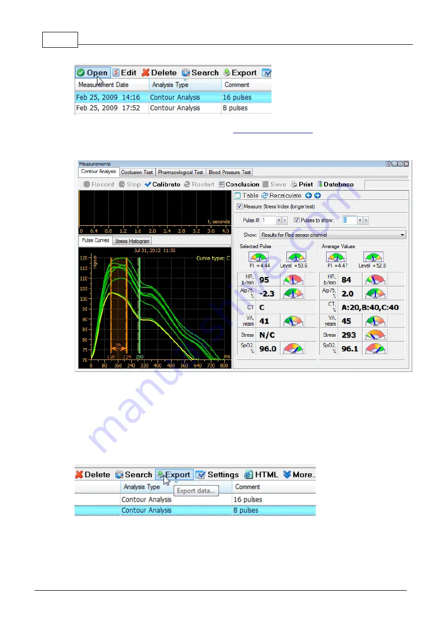 Angioscan Electronics AngioScan-01 User Manual Download Page 76